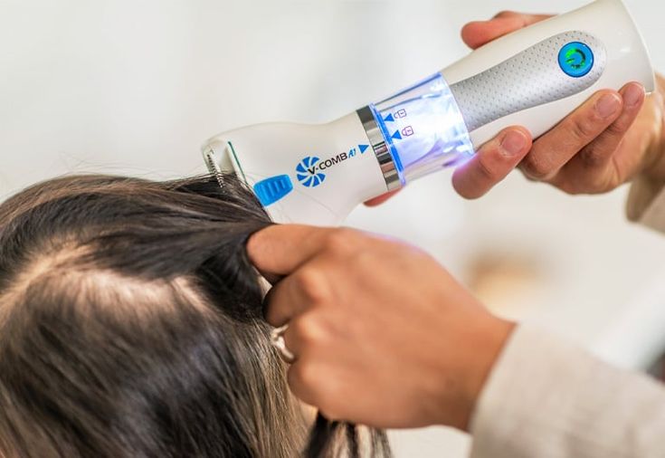 🌟🧴✨ V-Comb™ ScalpShield Anti-Lice Comb 🍃💙 💎 Target • Remove • Protect 🚿🌿
